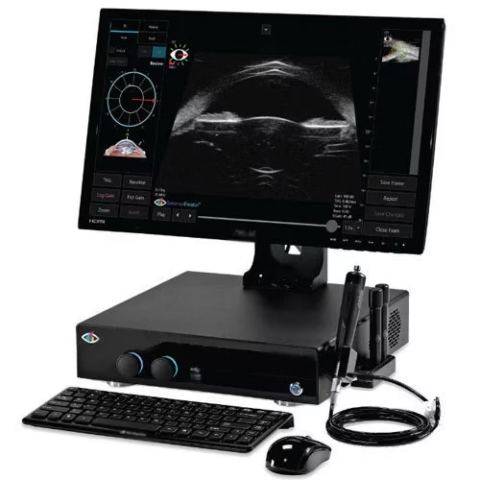 Vitreous haemorrhage: how ocular ultrasound supports assessment
