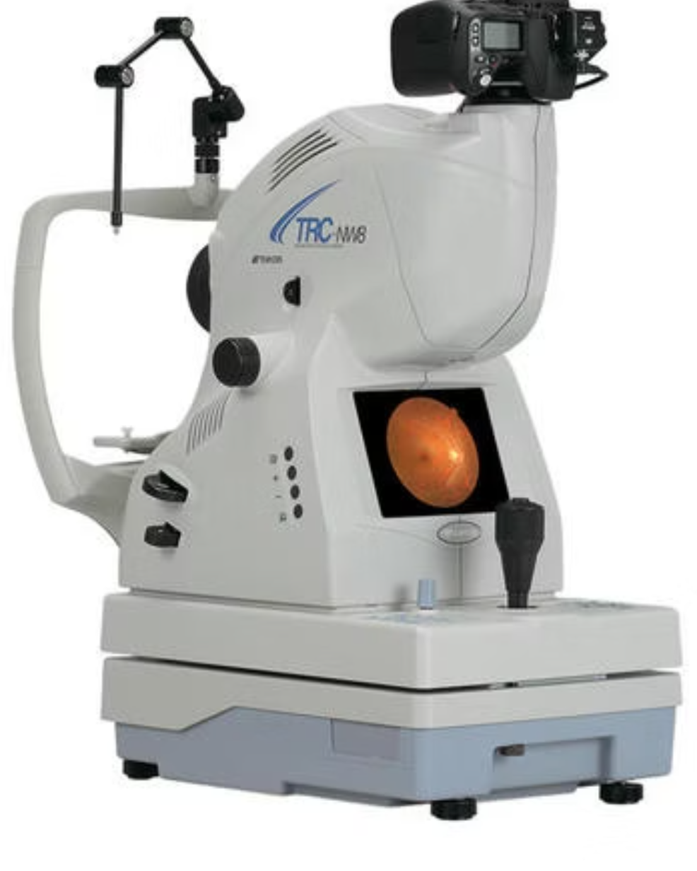 Optic-nerve photographs in glaucoma monitoring